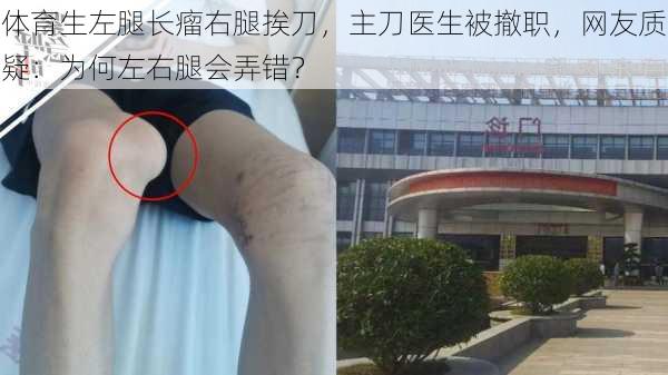 体育生左腿长瘤右腿挨刀，主刀医生被撤职，网友质疑：为何左右腿会弄错？