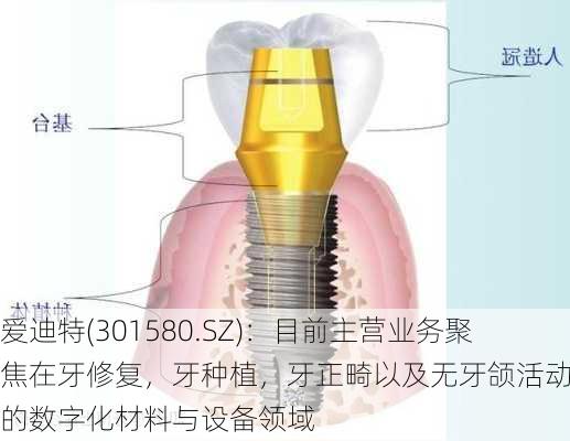 爱迪特(301580.SZ)：目前主营业务聚焦在牙修复，牙种植，牙正畸以及无牙颌活动修复的数字化材料与设备领域